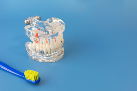 Transparent Pathological Tooth Model. Dental Education Implant Equipment And Toothbrush on Blue Background. Copy Space For text. Horizontal Mockup. Dentistry and Oral Health.の写真素材