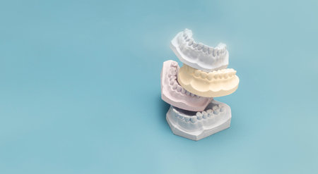 Mockup Many Die Stone, Plaster Cast Molds Of The Upper And Lower Jaws And Teeth With Pliable Imprint...
