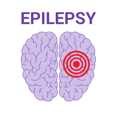 Epilepsy vector icon isolated on a white background.のイラスト素材
