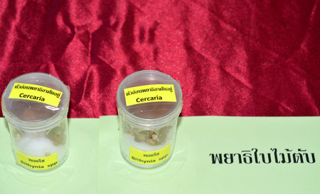 MAHASARAKHAM  JUNE 20 : Bithynia spp. and  cercariae are on display in health assembly seminar at...