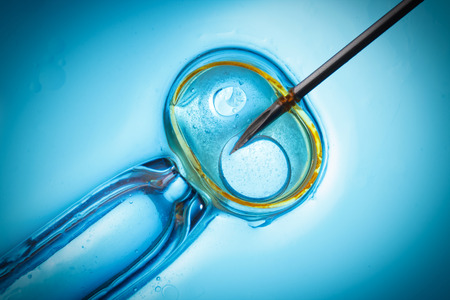 In vitro fertilisation, IVF macro conceptの写真素材