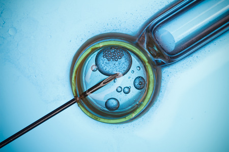 In vitro fertilisation, IVF macro conceptの写真素材