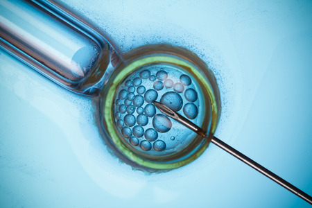 In vitro fertilisation, IVF macro conceptの写真素材
