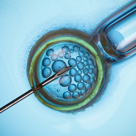 In vitro fertilisation, IVF macro conceptの写真素材