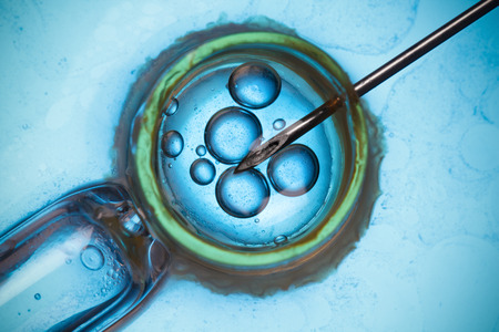 Laboratory microscopic research or IVF macro conceptの写真素材