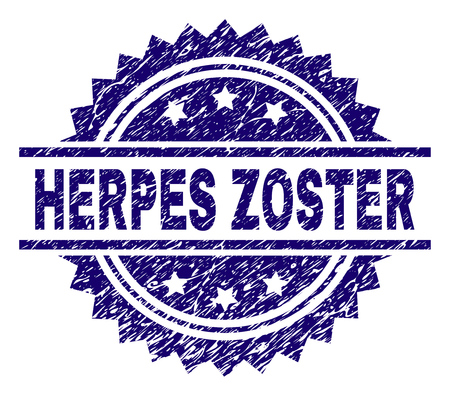 HERPES ZOSTER stamp seal watermark with distress style. Blue vector rubber print of HERPES ZOSTER tag with corroded texture.のイラスト素材