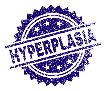 HYPERPLASIA stamp seal watermark with distress style. Blue vector rubber print of HYPERPLASIA label with dust texture.のイラスト素材