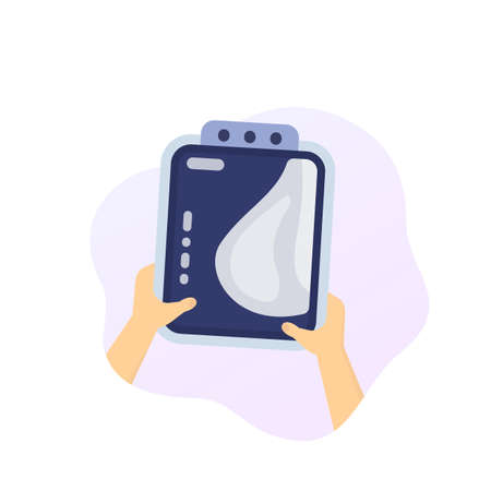 Mammogram in hands, breast scan, vectorのイラスト素材