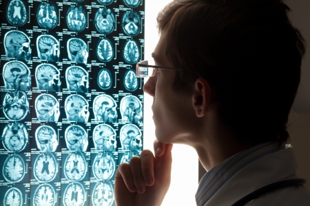 Image of male doctor looking at x-ray resultsの写真素材