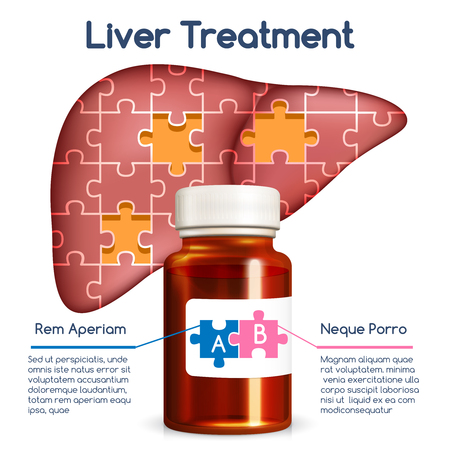 Liver treatment concept. Medical health human, bottle and puzzle, medicine and organ, vector illustrationのイラスト素材
