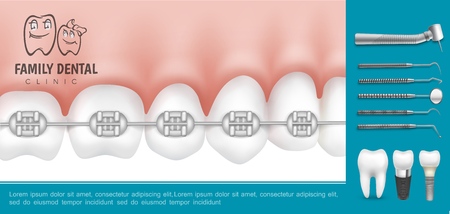 Realistic dentistry and stomatology composition with metal braces on teeth stomatological medical instruments and dental implants vector illustrationのイラスト素材