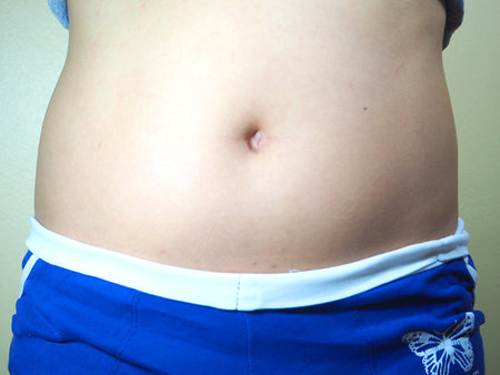 Belly fat woman on background