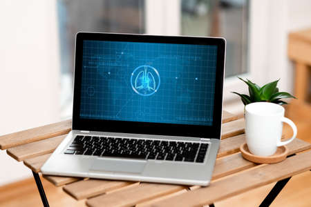 Laptop Resting On A Table Beside Coffee Mug And Plant Showing Work Process. Minicomputer Sitted Top...