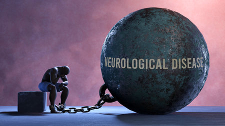 Neurological disease that limits life and make suffer, imprisoning in painful condition. It is a burden that keeps a person enslaved in misery.,3d illustrationの写真素材