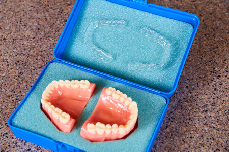 Dental Impressions in Blue Case on Countertop - Dentist Office Perspective
