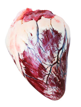 fatty heart isolated on white backgroundの写真素材