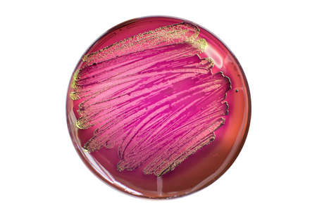 Escherichia coli bacterial colonies on MacConkey agar media