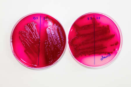 E coli bacteria grow characteristics on selective media