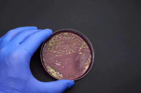 bacterial colonies of E coli on selective medium plate on black background