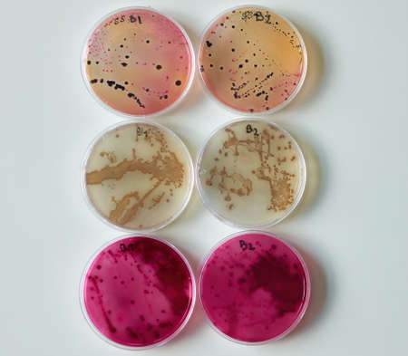 Bacterial colony on selective media Agar Plates in petri dish
