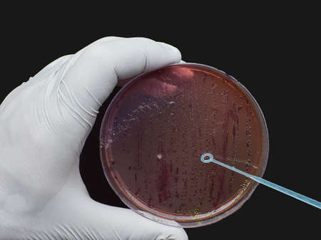 scientist pick-up Bacterial Colony with disposable loop cultured in agar medium