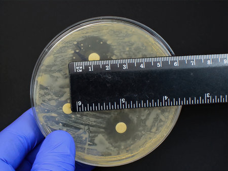 antimicrobial antibiotic resistance disc test interpretation measuring rulerの写真素材