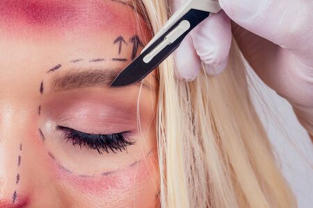 Pretty blonde  woman in medical beauticians hands with syringes making  injection in her face closeup linesの写真素材