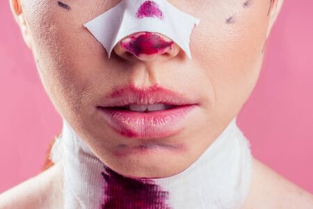 Patient in bandages. Nurses and young woman in studio pink background.の写真素材