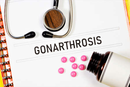 Gonarthrosis-text inscription on a medical folder. Deforming arthrosis of the knee joint is diagnosed by a doctor. Medication treatment.の写真素材