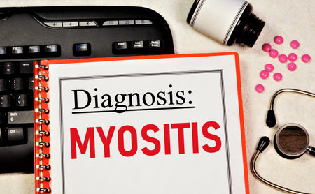 Myositis. Text inscription of the medical diagnosis. Treatment with medications and procedures.の写真素材