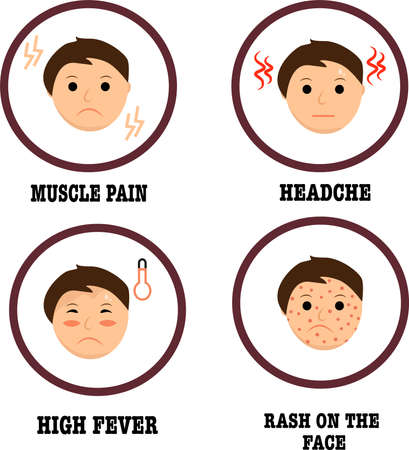 Monkeypox virus Symptoms. Monkey pox. Vector illustration. Monkeypox virus Symptom infographics. Vector monkey pox symbol or icon.のイラスト素材