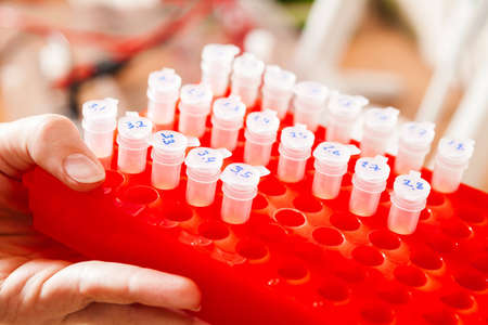 Rack of Eppendorf test tubes held in handの写真素材