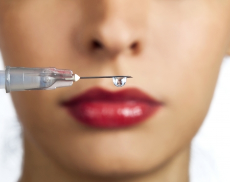 Treatment with botox or hyaluronic collagen HA injectionの写真素材