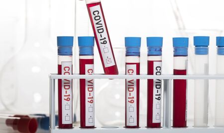 Tubes of biological sample contaminated by Coronavirus with label Covid-19 on white background