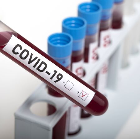Tubes of biological sample contaminated by Coronavirus with label Covid-19 on white background