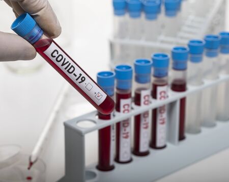 Microbiologist with a tube of biological sample contaminated by Coronavirus with label Covid-19 on...