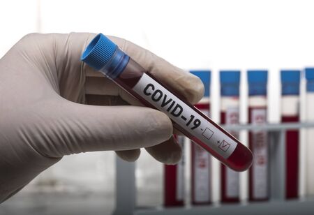 Microbiologist with a tube of biological sample contaminated by Coronavirus with label Covid-19 on white backgroundの写真素材