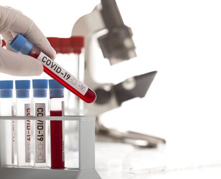 Microbiologist with a tube of biological sample contaminated by Coronavirus with label Covid-19 on...
