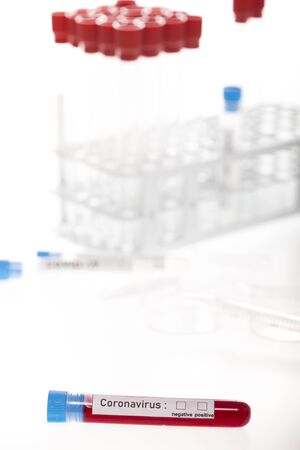 Tubes of biological sample contaminated by Coronavirus with label Covid-19 on white backgroundの写真素材