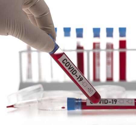 Microbiologist with a tube of biological sample contaminated by Coronavirus with label Covid-19 on white backgroundの写真素材