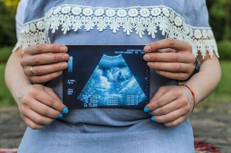 Young couple in love with a pregnant woman holds in their hands a picture of an ultrasound with an unborn babyの写真素材