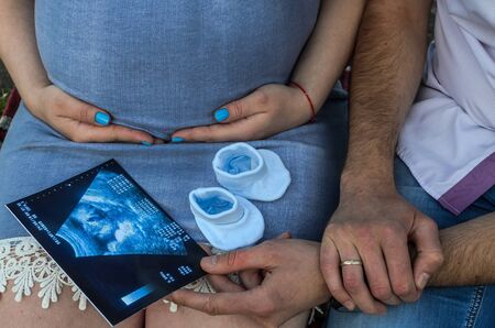 Young couple in love with a pregnant woman holds in their hands a picture of an ultrasound with an unborn babyの写真素材