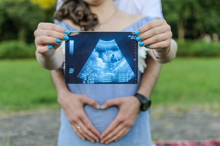 Young couple in love with a pregnant woman holds in their hands a picture of an ultrasound with an unborn babyの写真素材