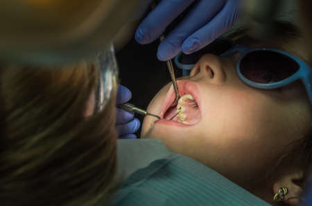 Children's dentist treats baby teethの写真素材