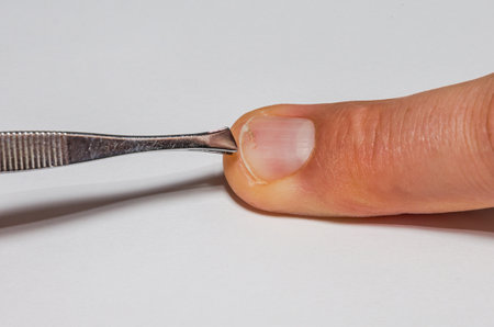 First aid for a patient with a broken fingernail