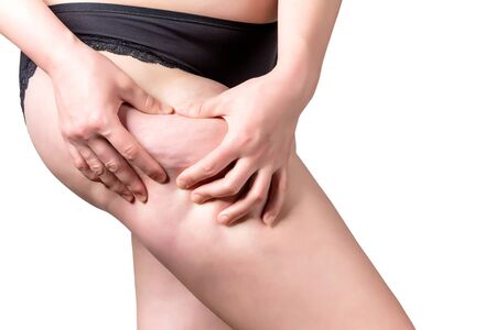 A young woman holding hands on a hip flask points to cellulite 2018の写真素材