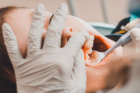 The boy examined by an orthodontist, he opened his mouth wide and the dentist examined his teeth.2020の写真素材