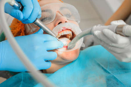Dentist ultrasound removes stones on the teeth of a woman with a dental pad on her mouth.2020の写真素材