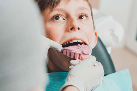 Registration of impressions and bites in a young teenager. Functional modern dental diagnostics 2020の写真素材