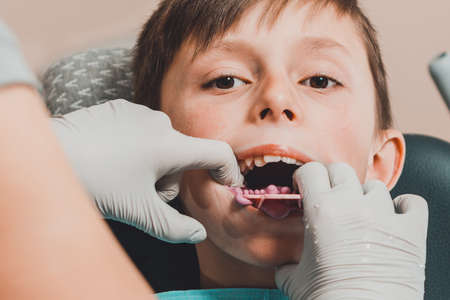 Boy in dentist chair with dental impression tray in her mouth 2020の写真素材